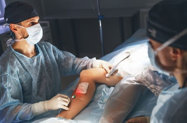 varicose vein surgery with a laser